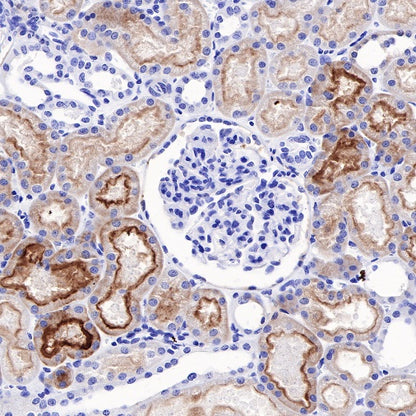 Human folate receptor alpha Recombinant Rabbit mAb (SDT-719-20-2)