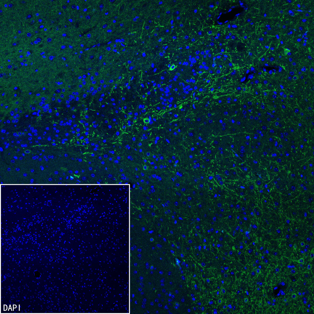 GABRA1 Recombinant Rabbit mAb (S-3254-10)