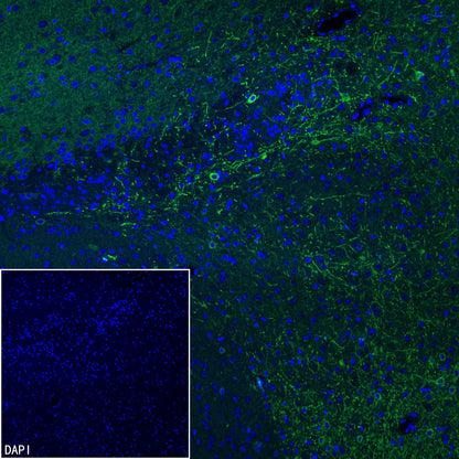 GABRA1 Recombinant Rabbit mAb (S-3254-10)