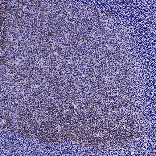 DHFR Recombinant Rabbit mAb (S-2542-9)