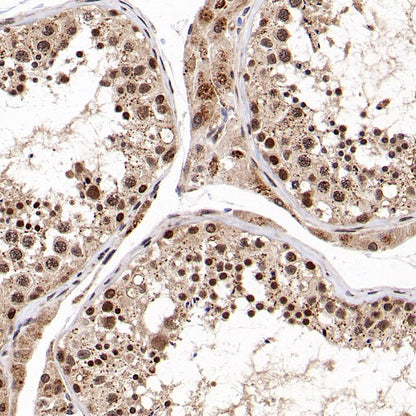 SMARCD1 Rabbit Polyclonal Antibody