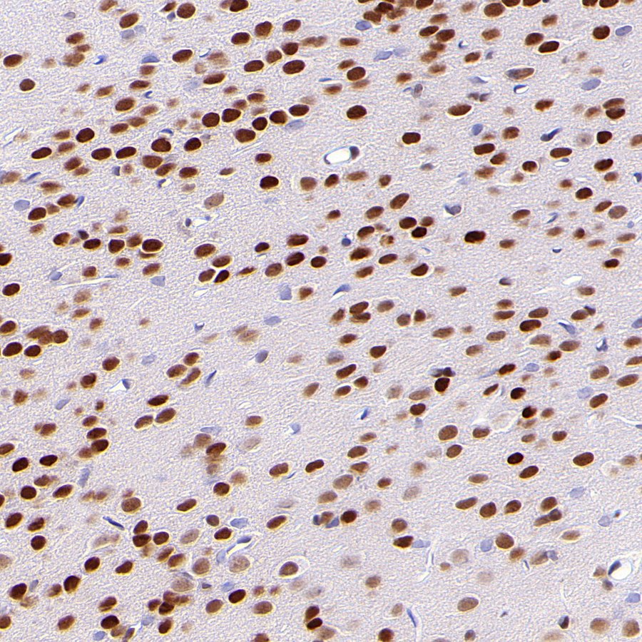 JUND Recombinant Rabbit mAb (S-4270-48)