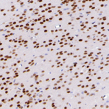 JUND Recombinant Rabbit mAb (S-4270-48)