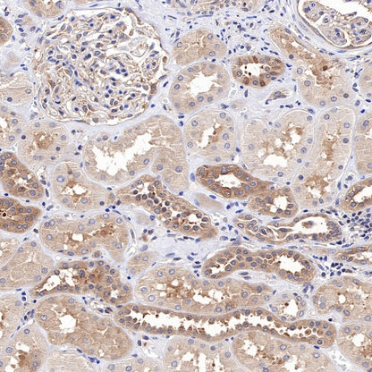 PP2A C Subunit Rabbit polyclonal antibody
