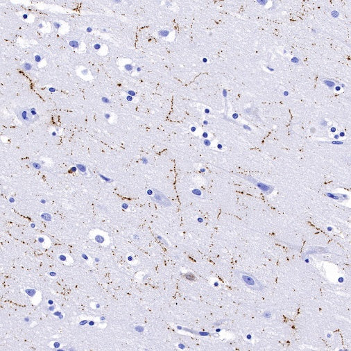 Neuropeptide Y Recombinant Rabbit mAb (S-1104-18)