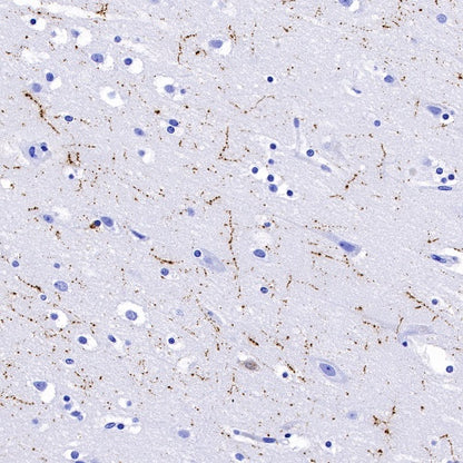 Neuropeptide Y Recombinant Rabbit mAb (S-1104-18)
