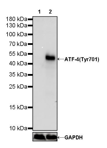 ATF-4 Recombinant Rabbit mAb (S-471-111)