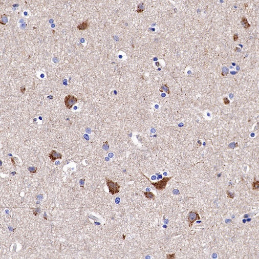 Syntenin Recombinant Rabbit mAb (S-1692-5)