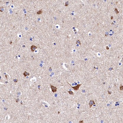 Syntenin Recombinant Rabbit mAb (S-1692-5)