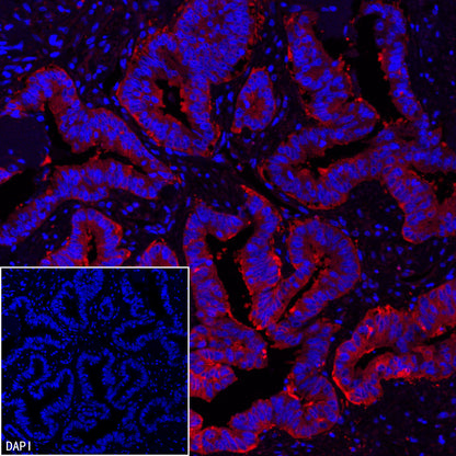 FASN Recombinant Rabbit mAb (Alexa Fluor® 555 Conjugate) (S-682-32)