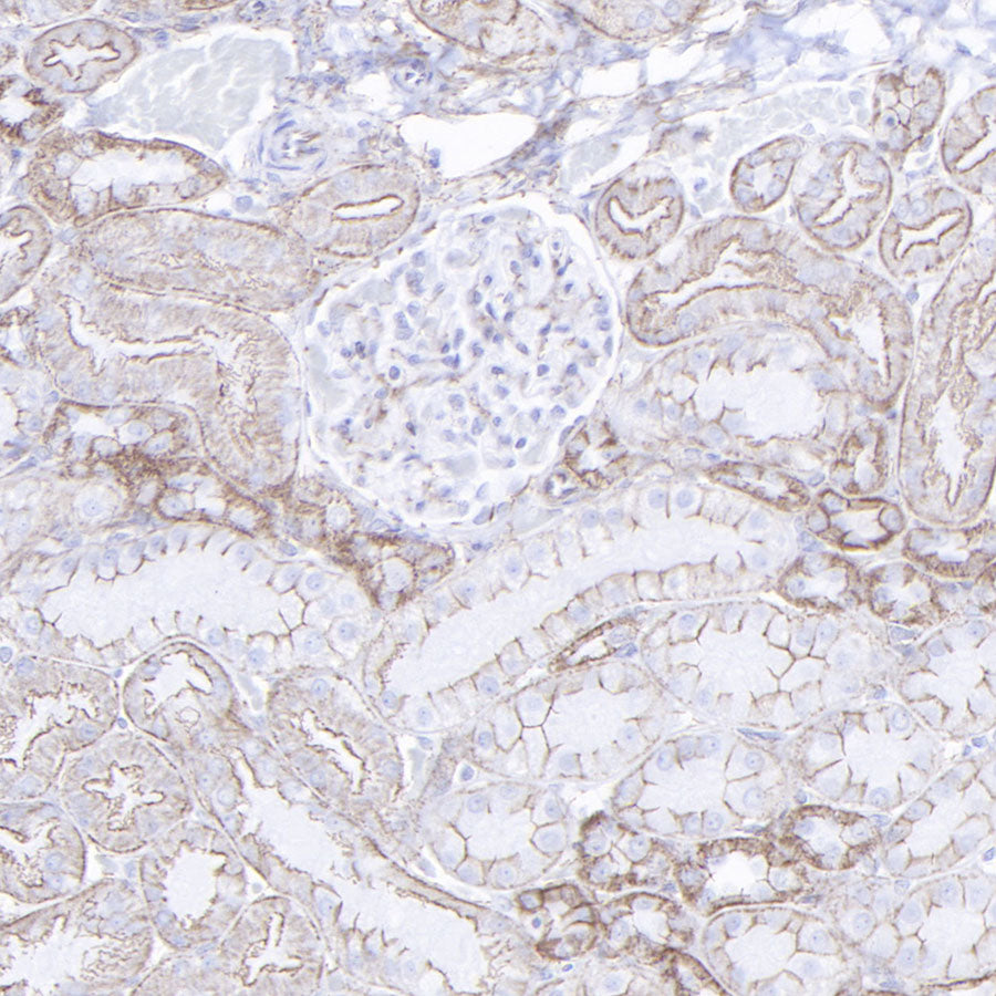 β-Catenin Recombinant Rabbit mAb,PBS Only (SDT-336-23)