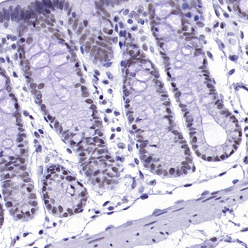 CDK9 Recombinant Rabbit mAb (S-2661-10)