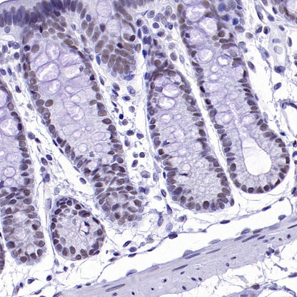 CDK9 Recombinant Rabbit mAb (S-2661-10)