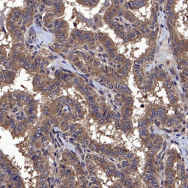 IRF3 Recombinant Rabbit mAb (S-4395)