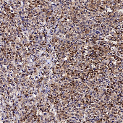 Stat5 Recombinant Rabbit mAb (S-2823-24)