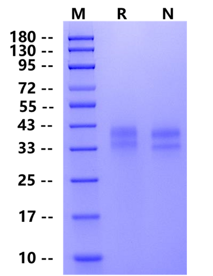 Biotinylated FOLR1 His&Avi Tag Protein, Mouse