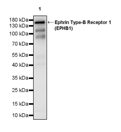 Ephrin Type-B Receptor 1 (EPHB1) Recombinant Rabbit mAb (S-4151-65)