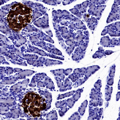 Somatostatin Receptor 2 Recombinant Rabbit mAb (SDT-2507-1)