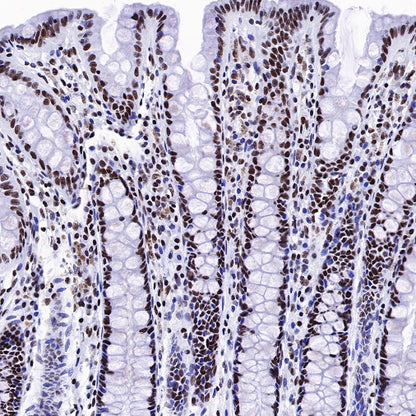 Nog1 Recombinant Rabbit mAb (S-R330)