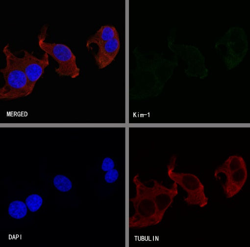 KIM-1 Recombinant Rabbit mAb (S-932-2)