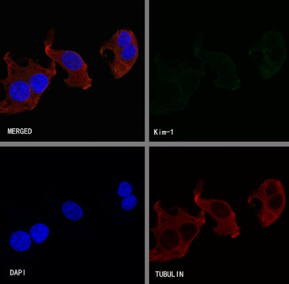 KIM-1 Recombinant Rabbit mAb (S-932-2)