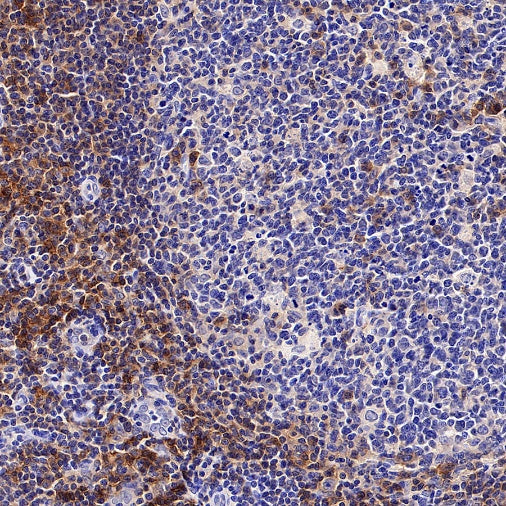 EBV Induced Gene 2/EBI2 Recombinant Rabbit mAb (S-5946)