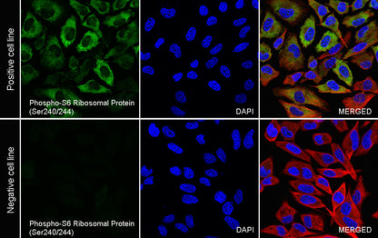 Phospho-S6 Ribosomal Protein (Ser240/244) Recombinant Rabbit mAb (S-4983)