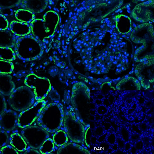 Ndufs4 Recombinant Rabbit mAb (S-1459-14)
