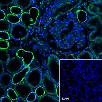 Ndufs4 Recombinant Rabbit mAb (S-1459-14)