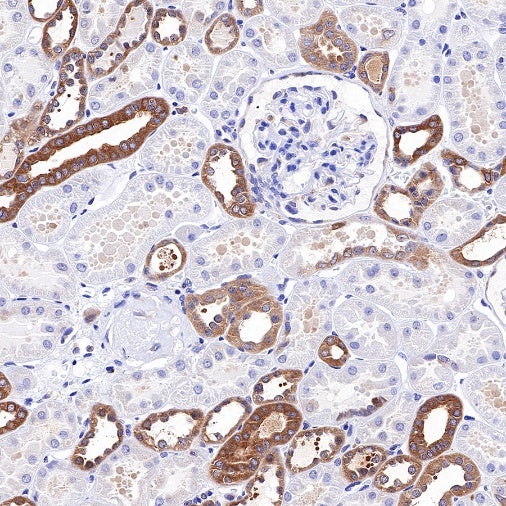 PKM Recombinant Rabbit mAb (S-812-20)
