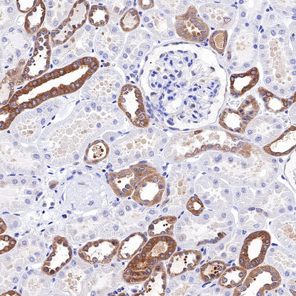 PKM Recombinant Rabbit mAb (S-812-20)