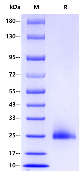 Mouse NK1.1/CD161, His tag