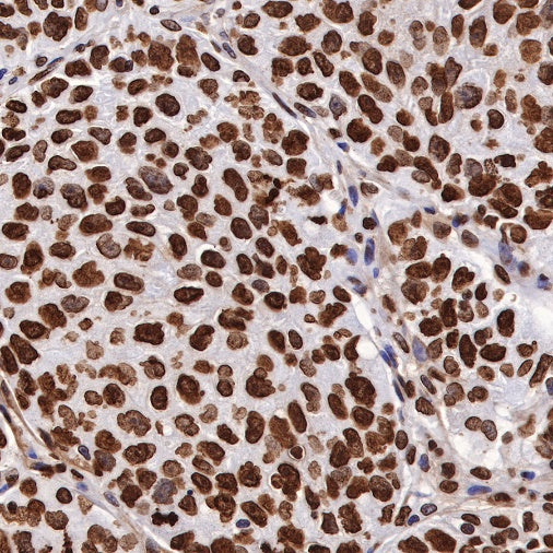 Histone H3 (tri methyl K27) Recombinant Rabbit mAb (SDT-431-118)