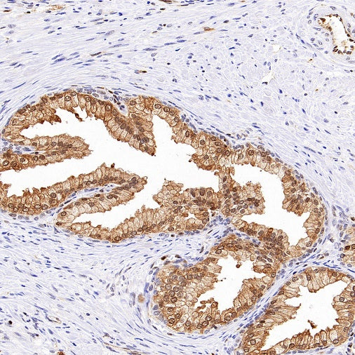 ACLY/ATP citrate lyase Recombinant Rabbit mAb (S-2025-32)