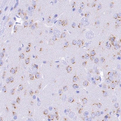 M6PR Recombinant Rabbit mAb (S-1480-21)