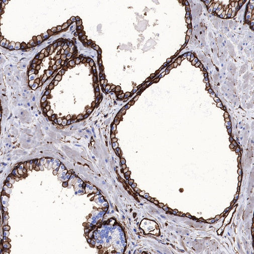 S-RMab®Annexin A2 Recombinant Rabbit mAb (SDT-444-67)