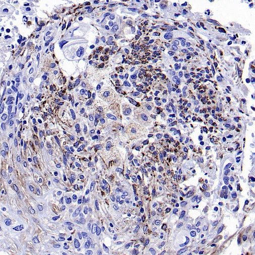 SOD2/MnSOD (acetyl K68) Rabbit Polyclonal Antibody