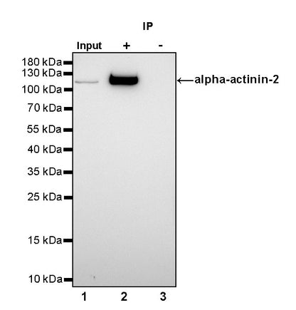 alpha-actinin-2 Recombinant Rabbit mAb (SDT-032-79)