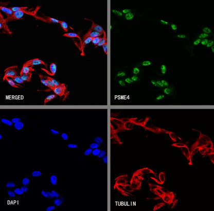 PSME4 Recombinant Rabbit mAb (S-3132-44)