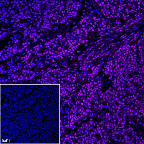 TEL1 Recombinant Rabbit mAb (S-3067-60)
