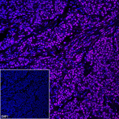 TEL1 Recombinant Rabbit mAb (S-3067-60)