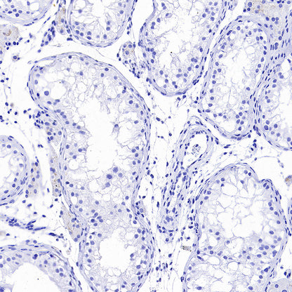 GRIA2 Recombinant Rabbit mAb (S-3446-123)