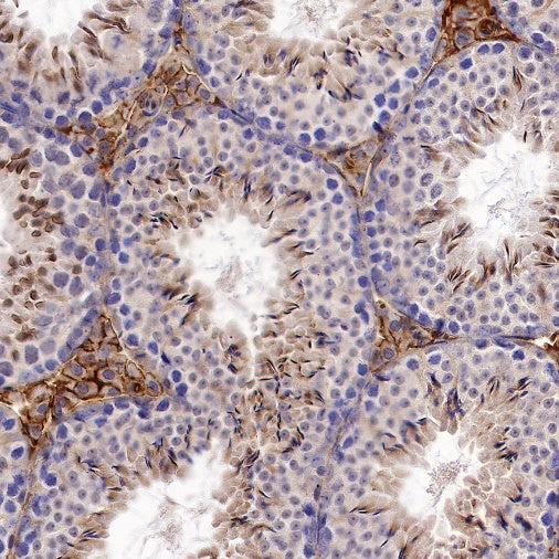 Trim30a Recombinant Rabbit mAb (S-1753-35)