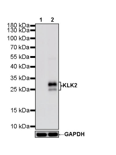 KLK2 Recombinant Rabbit mAb,PBS Only (SDT-4461-80)