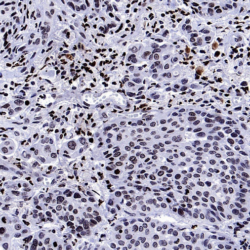 Cyclin E1 Recombinant Rabbit mAb (SDT-2512-182)