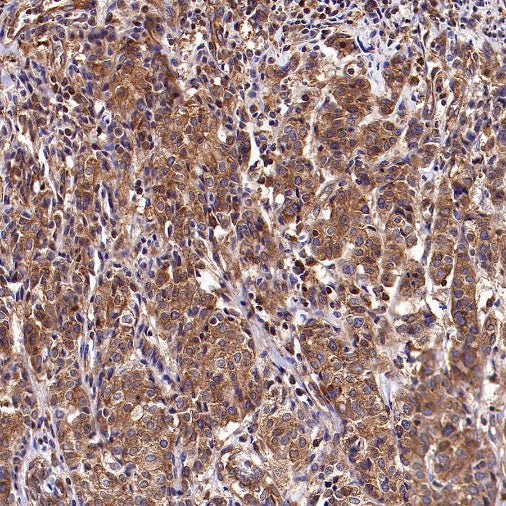 Dynamin 2 Recombinant Rabbit mAb (S-1751-209)