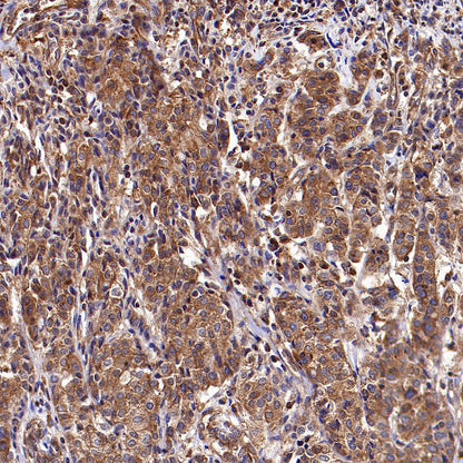 Dynamin 2 Recombinant Rabbit mAb (S-1751-209)
