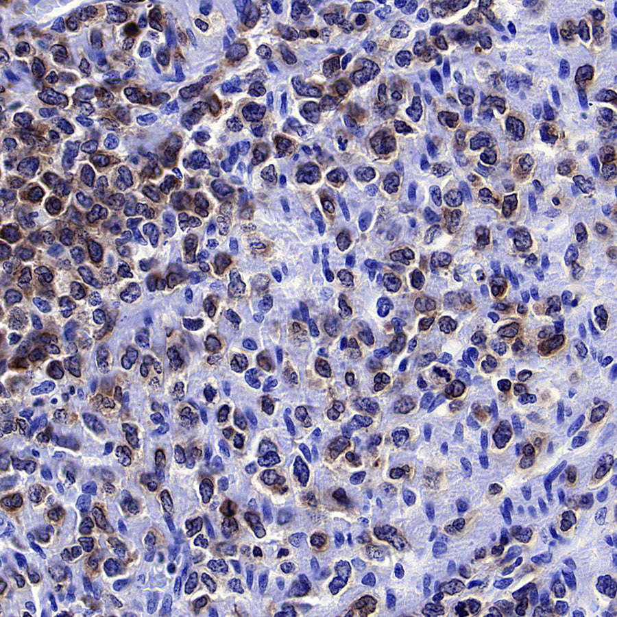 CD96 Recombinant Rabbit mAb (S-5322)