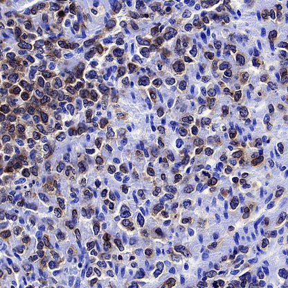 CD96 Recombinant Rabbit mAb (S-5322)