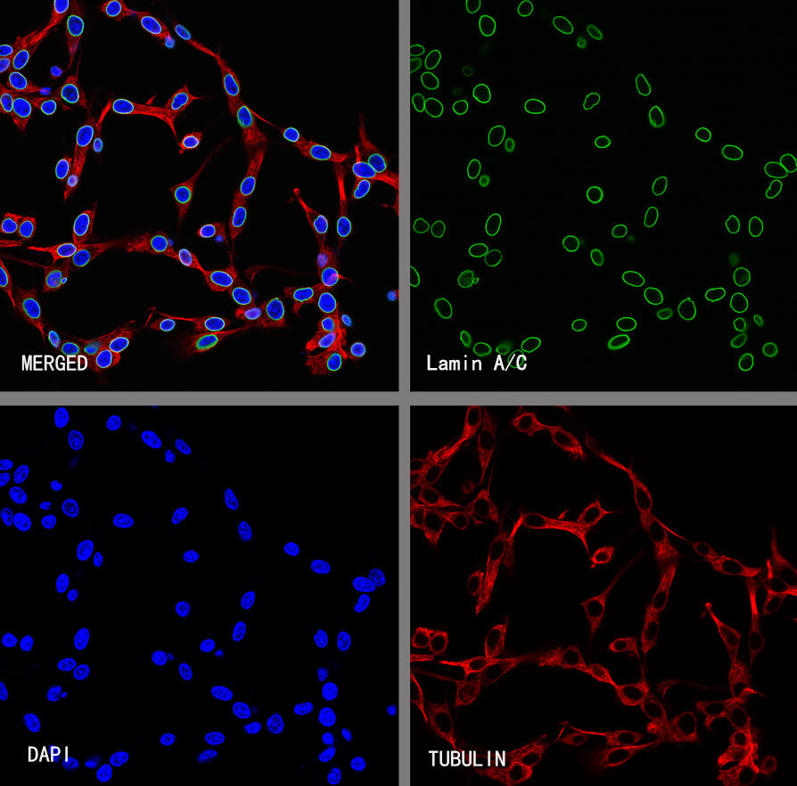 Lamin A/C Recombinant Rabbit mAb (S-5671)
